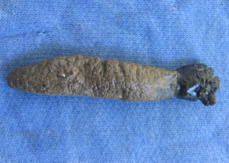 Pawsonia saxicola (Brady & Robertson, 1871)